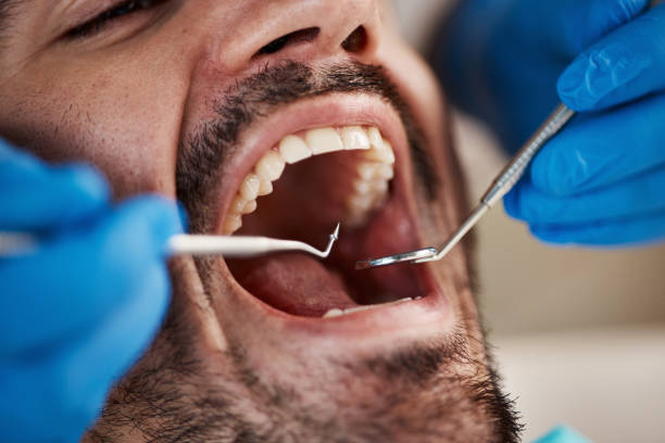 Best Emergency Wisdom Teeth Removal in Fowlerville, MI